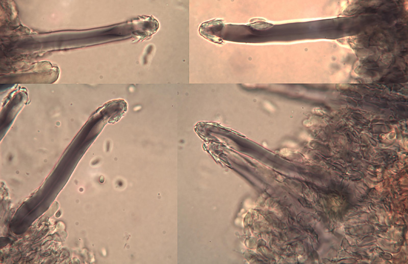 Tubulicrinis calothrix micro